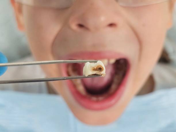 Best Emergency Gum Treatment in Gearhart, OR